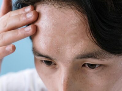 Podstawy trychologii – nauki o zdrowiu włosów i skóry głowy